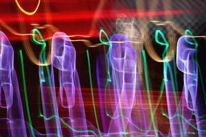Night exposure zoom traces background. Light lines leaks exposition backdrop. Night city rays glow texture. photo