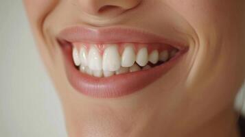 Close-up of a womans smile with bright white teeth photo
