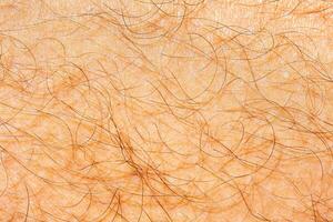 humano piel cubierto con cabello. foto