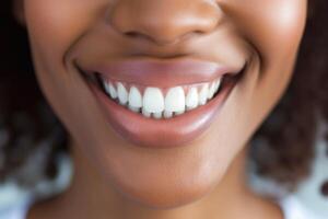 Close up shot of a black woman smiling with perfect white teeth photo