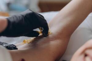Sugaring. epilation with liquate sugar at armpit. photo