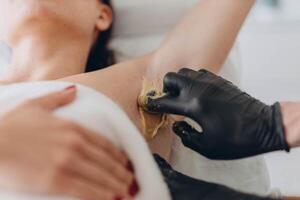 Sugaring. epilation with liquate sugar at armpit. photo