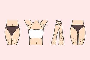 Hairy female legs and thighs in need of depilation or epilation using wax tape and sugaring vector