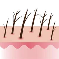 Damaged and split ends hair on scalp layer illustration isolated on white background. Dryness, baby split, y split, incomplete, knot, taper, tree and feather. Hair care and problem concept. vector