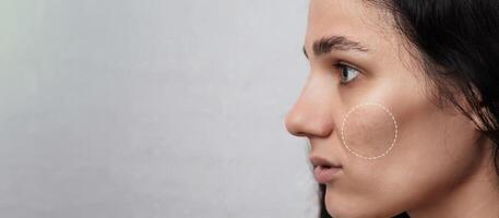 Close-up of a young girl with skin problems. Pimples, acne, pores, scars. Natural skin with and without filters. A place for your text. photo