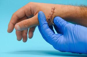 Examination and care of postoperative sutures on the patient's shoulder photo