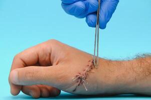 Examination and care of postoperative sutures on the patient's shoulder photo