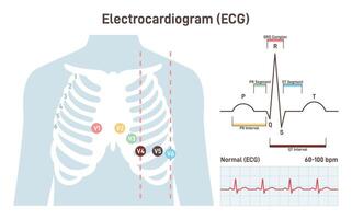 ECG procedure. Cardiovascular checkup with cardiogram. Heart disease vector