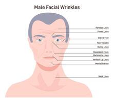 Mimic wrinkles. Age-related skin changes. Aging process, forehead vector