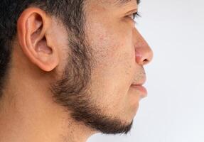 Side view of Asian man face with beard grows on a part of his face. Beard is the collection of hair that grows on the chin, upper lip, cheeks and neck of humans. photo