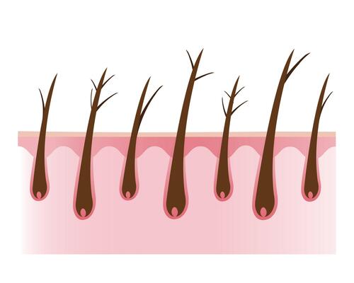 The cross section of damaged and types of split ends hair with scalp layer illustration isolated on white background. Dryness, baby split, y split and tree. Hair care and problem concept.