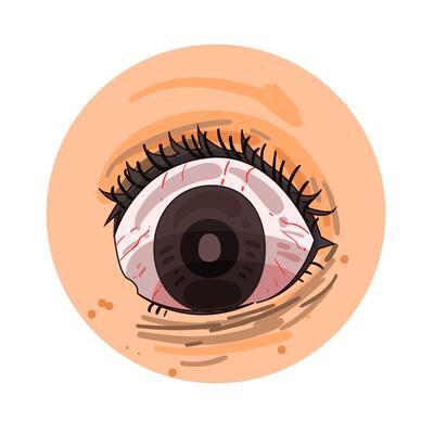 Illustration of red eye