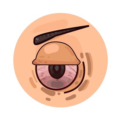 Illustration of red eye