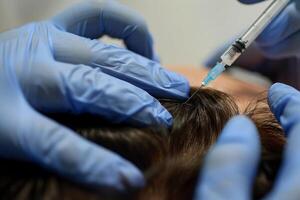 Hair regeneration, Plasma injection into the hair on a woman 's head .a cosmetologist makes plasma injections into the scalp photo
