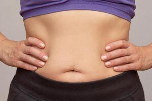 Cropped woman body with hands on waist showing belly sagging skin after diet and stretch marks after pregnancy over gray background photo