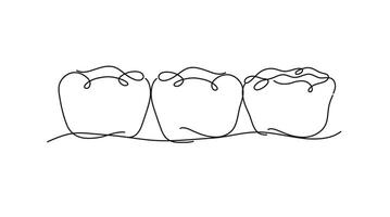 implantado dientes con corona puente ilustración dibujo en plano línea estilo en blanco antecedentes vector