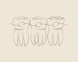 Teeth with braces illustration drawing in linear style on beige background vector