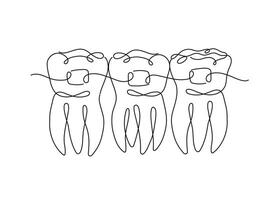 Teeth with braces illustration drawing in flat line style on white background vector