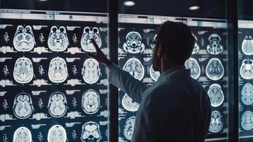 A doctor gesturing towards a series of brain scan images displayed on a lightbox in a consultation room photo