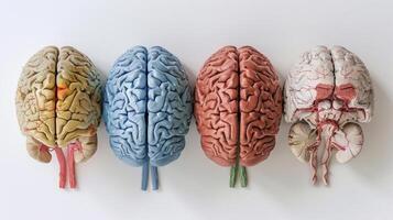 A visual guide to the different lobes of the brain frontal parietal temporal and occipital and their associated functions photo
