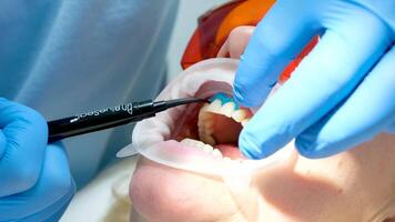 Whiten teeth liquid cofferdam to isolate the gums from the action of a bleaching agent optragat rotary spreader Teeth whitening procedure with ultraviolet light UV lamp. dentist in the clinic video