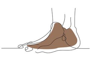 Feet of a man suffering from gooodle continuous line art illustration vector