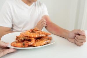 food allergies, men have reactions itching and redness after eating shrimp, seafood allergy, itching, rash, abdominal pain, diarrhea, chest tightness, unconsciousness, death, severe avoid allergies photo