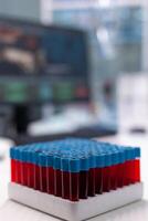 Close up of vacutainers with blood in science laboratory. Glass tubes on tray filled with substance for testing and analysis. Transparent glassware with liquid in biochemistry cabinet photo