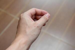 Scars on the hands caused by wounds that form dark spots show the texture of the skin of the hands in blurred background. photo