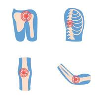 Joint inflammation icons set cartoon . Human joint with pain ring vector