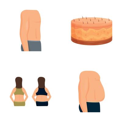 Liposuction icons set cartoon . Human body before and after surgery
