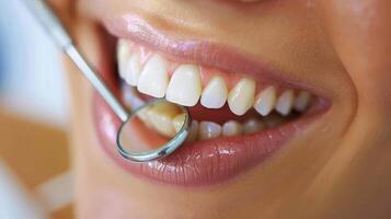 Close-up of young female having her teeth examined isolated on white background. photo
