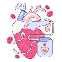 Artificial cardiac pacemaker. Medical device that generates electrical vector