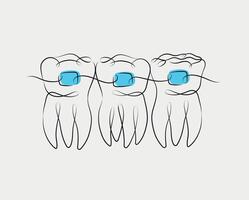 Teeth with braces illustration drawing in linear style on white and blue background vector