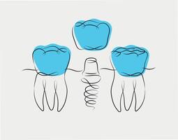 Teeth implant illustration drawing in linear style on white and blue background vector