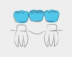 Teeth with crown bridge illustration drawing in linear style on white and blue background vector
