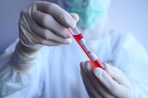 Scientist doctor holding a sample test tube with blood for 2019-nCoV analyzing. Conceptual of laboratory testing for the respiratory coronavirus disease 2019 photo