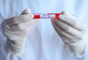Close up of scientist doctor hand holding a sample test tube with blood for 2019-nCoV analyzing. Conceptual of laboratory testing for the respiratory coronavirus disease 2019. photo