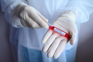 Close up of scientist doctor hand holding a sample test tube with blood for 2019-nCoV analyzing. Conceptual of laboratory testing for the respiratory coronavirus disease 2019. photo