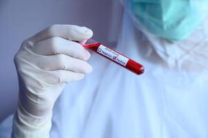 Scientist doctor holding a sample test tube with blood for 2019-nCoV analyzing. photo