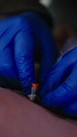 Vertical Close up with confident movements, a medic in blue gloves grasps the needle that he inserted into the chest and stabilizes it with the help of special tape while providing first aid in video