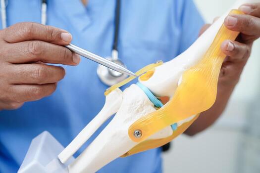 Knee osteoarthritis, Doctor showing model knee joint orthopedic. photo