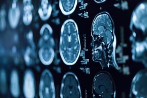 Detailed mri scan images displaying brain cross-sections for diagnostics photo