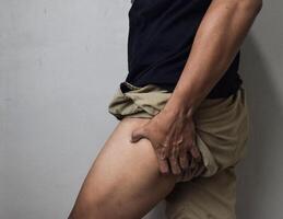 Fat thighs, Cellulite of of middle-aged man photo