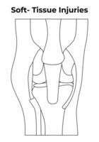 Soft TIssue Injuries Science Design Lineart Illusttation Diagram vector