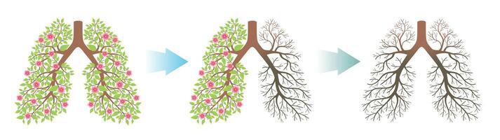 Lungs. Consequences of different degrees of lung disease vector