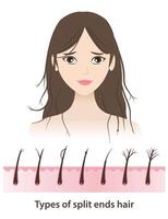 The woman with types of split ends hair illustration on white background. Cross section of baby split, y split, incomplete, knot, taper, tree, feather with scalp layer. Hair care concept. vector