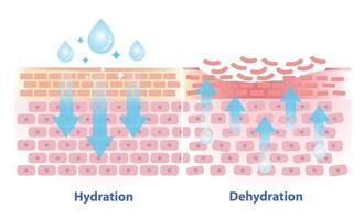 The mechanism of hydration and dehydration skin layer illustration isolated on white background. Comparison of skin absorb water, moisture and dry skin lacks water in the uppermost layer. vector
