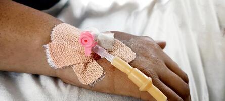Young woman with a cannula inserted into her right hand and lying on a bed at a hospital, in order to administer intravenous fluids. photo