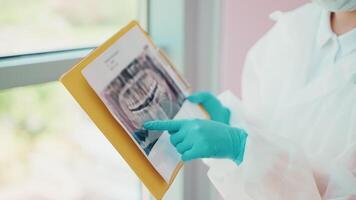 stomatologist showing x-ray scan of patient teeth and explaining plan of treatment, closeup view video